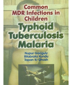 Common Mdr Infections In Children Typhoid Tuberculosis Malaria