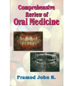 Comprehensive Review Of Oral Medicine
