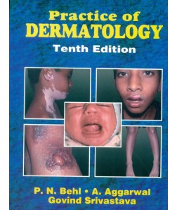 Practice Of Dermatology, 10E