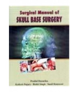 Surgical Manual Of Skull Base Surgery