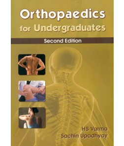 Orthopaedics For Undergraduates, 2E