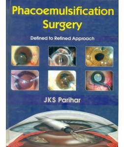 Phacoemulsification Surgery Defined To Refined Approach
