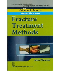 Fracture Treatment Methods (Handbook In Orthopedics And Fractures Vol.02 - Orthopedic Trauma General Fractures)