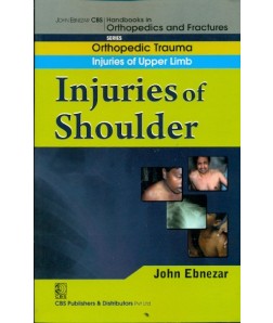 Injuries Of Shoulder (Handbook In Orthopedics And Fractures Series, Vol. 5 - Orthopedic Trauma Injuries Of Upper Limb)