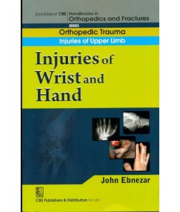 Injuries Of Wrist And Hand (Handbook In Orthopedics And Fractures Vol.9 - Orthopedic Trauma Injuries Of Upper Limb)