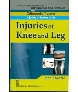 Injuries Of Knee And Leg ( Handbook In Orthopedics And Fractures Series Vol.16- Orthopedic Trauma Injuries Of Lower Limb)