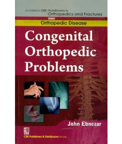 Congenital Orthopedic Problems (Handbooks In Orthopedics And Fractures Series, Vol.28: Orthopedic Disease)A)