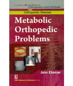 Metabolic Orthopedic Problems  (Handbooks In Orthopedics And Fractures Series, Vol.30: Orthopedic Disease))