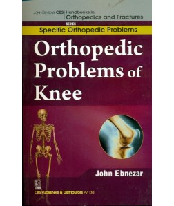 Orthopedic Problems Of Knee (Handbooks In Orthopedics And Fractures Series, Vol. 41: Specific Orthopedic Problems)