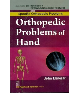 Orthopedic Problems Of Hand (Handbooks In Orthopedics And Fractures Series, Vol.47: Specific Orthopedic Problems)