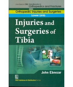 Injuries And Surgeries Of Tibia (Handbooks In Orthopedics And Fractures Series, Vol. 57: Orthopedic Injuries And Surgeries Lower Limb)