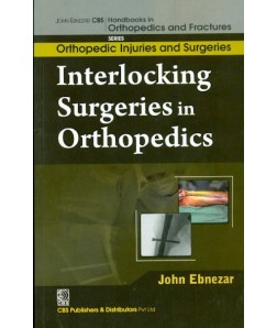 Interlocking Surgeries In Orthopedics (Handbooks In Orthopedics And Fractures Series, Vol. 60-Orthopedic Injuries And Surgeries)