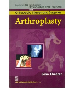 Arthroplasty (Handbooks In Orthopedics And Fractures  Series, Vol. 62 -Orthopedic Injuries And Surgeries)