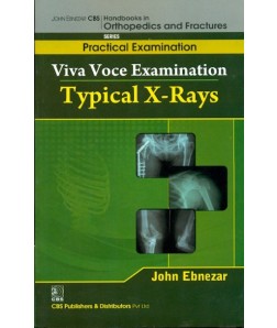 Typical X-Rays (Handbooks In Orthopedics And Fractures Series, Vol. 65-Practical Examination)