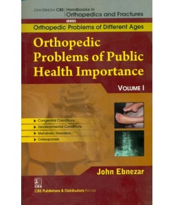 Orthopedic Problems Of Public Health Importance (Handbooks Of Orthopedics And Fractures Series, 1, Vol. 82 Orthopedic Problems Of Different  Ages )