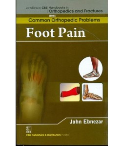 Foot Pain (Handbooks In Orthopedics And Fractures Series, Vol. 91- Common Orthopedic Problems)