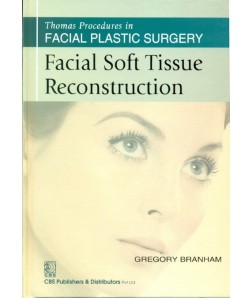 Facial Soft Tissue Reconstruction (Thomas Procedures In Facial Plastic Surgery)- Sie