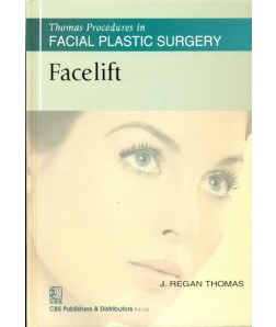 Thomas Procedures In Facial Plastic Surgery: Facelift