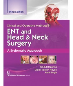 Clinical and Operative Methods in ENT and Head & Neck Surgery, A Systematic Approach