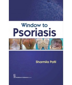 Window To Psoriasis(Hb 2016)
