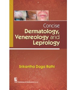 Concise Dermatology Venereology And Leprology (Pb 2017)