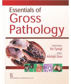 Essentials of Gross Pathology 