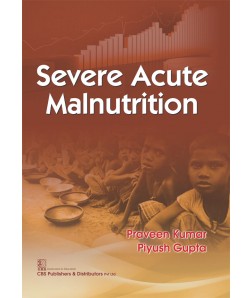 Severe Acute Malnutrition