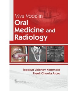 Viva Voce in Oral Medicine and Radiology 