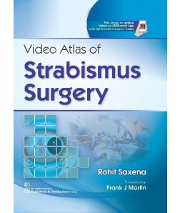 Video Atlas of Strabismus Surgery