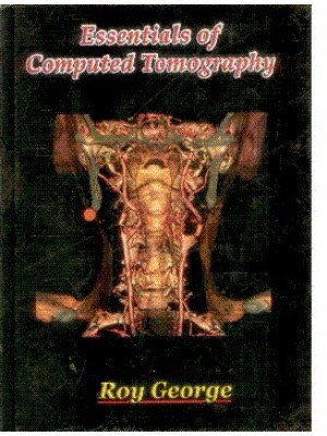 Essentials Of Computed Tomography