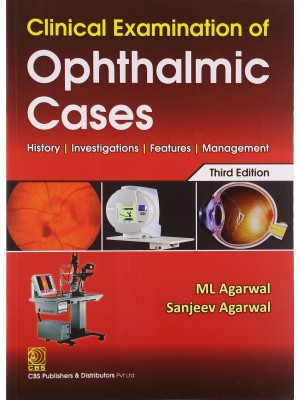 Clinical Examination of Ophthalmic Cases History | Investigations | Features | Management
