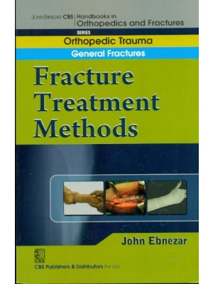 Fracture Treatment Methods (Handbook In Orthopedics And Fractures Vol.02 - Orthopedic Trauma General Fractures)