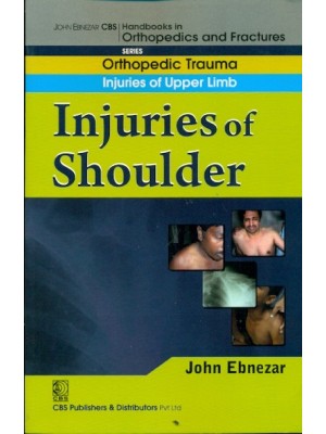 Injuries Of Shoulder (Handbook In Orthopedics And Fractures Series, Vol. 5 - Orthopedic Trauma Injuries Of Upper Limb)