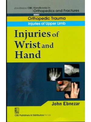 Injuries Of Wrist And Hand (Handbook In Orthopedics And Fractures Vol.9 - Orthopedic Trauma Injuries Of Upper Limb)