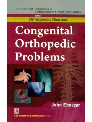 Congenital Orthopedic Problems (Handbooks In Orthopedics And Fractures Series, Vol.28: Orthopedic Disease)A)