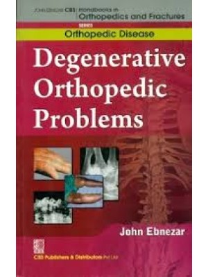 Degenerative Orthopedic Problems (Handbooks In Orthopedics And Fractures Series, Vol35: Orthopedic Disease)Ma)