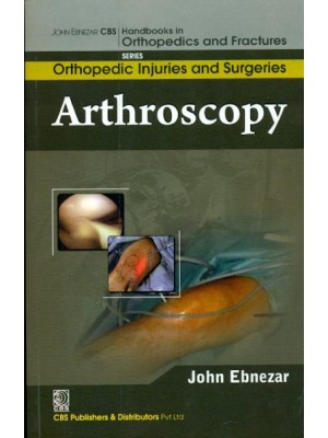 Arthroscopy (Handbooks In Orthopedics And Fractures Series, Vol. 61- Orthopedic Injuries And Surgeries)