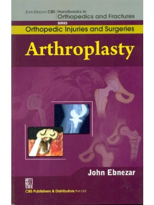 Arthroplasty (Handbooks In Orthopedics And Fractures  Series, Vol. 62 -Orthopedic Injuries And Surgeries)
