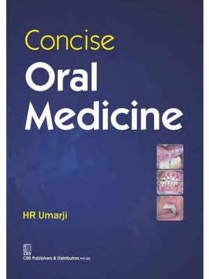Concise Oral Medicine (1st Reprint)