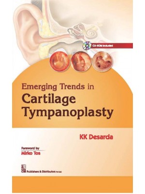Emerging Trends In Cartilage Tympanoplasty (2016)