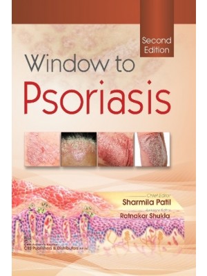 Window to Psoriasis, 2nd Edition
