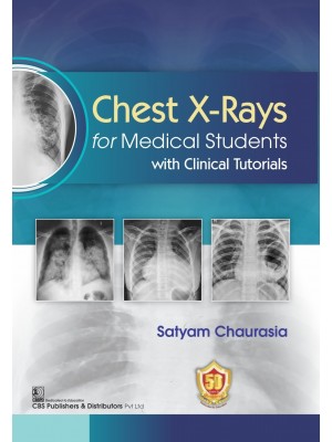 Chest X-Rays for  Medical Students with Clinical Tutorials