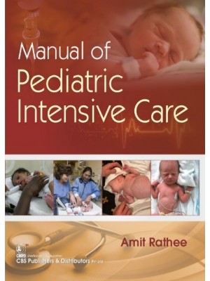 Manual of Pediatric Intensive Care