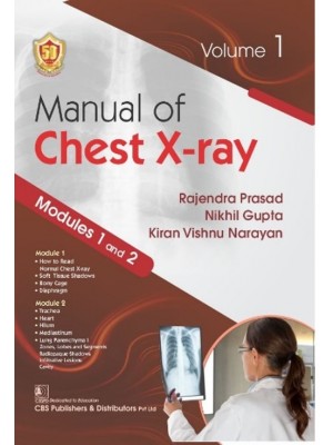 Manual of Chest X-ray, Volume 1 Modules 1 and 2