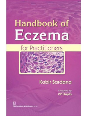 Handbook Of Eczema For Practitioners
