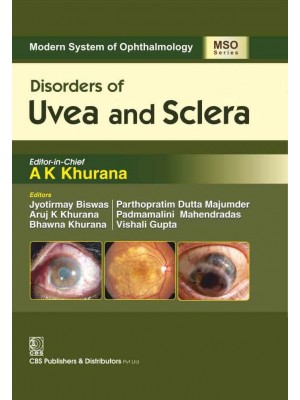Disorders Of Uvea And Sclera (Mso Series) 