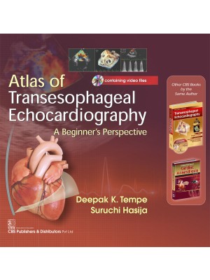 Atlas of Transesophageal Echocardiography a Beginner’s Perspective Included CD containing video files 