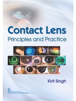 Contact Lens Principles and Practice