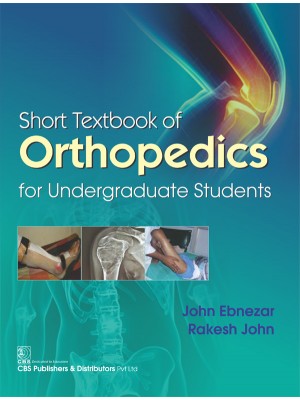 Short Textbook of Orthopedics for Undergraduate Students