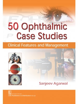 50 ophthalmic case studies clinical features and management